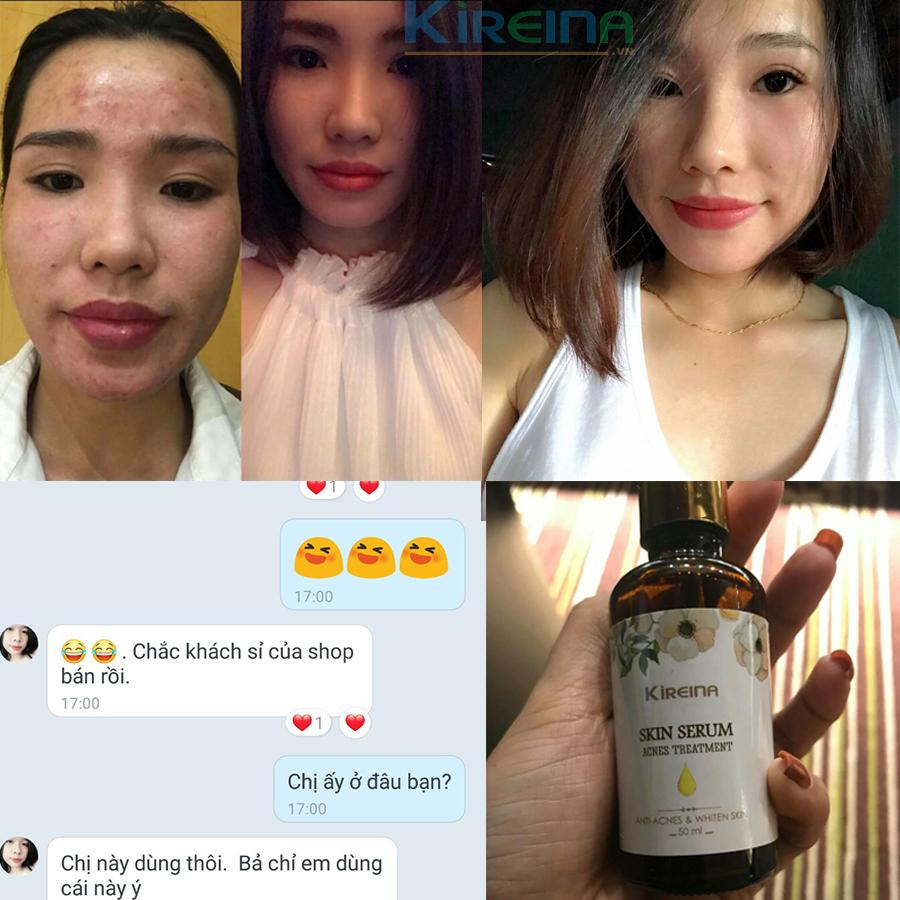 Khach hang cu gioi thieu cho KH moi.jpg