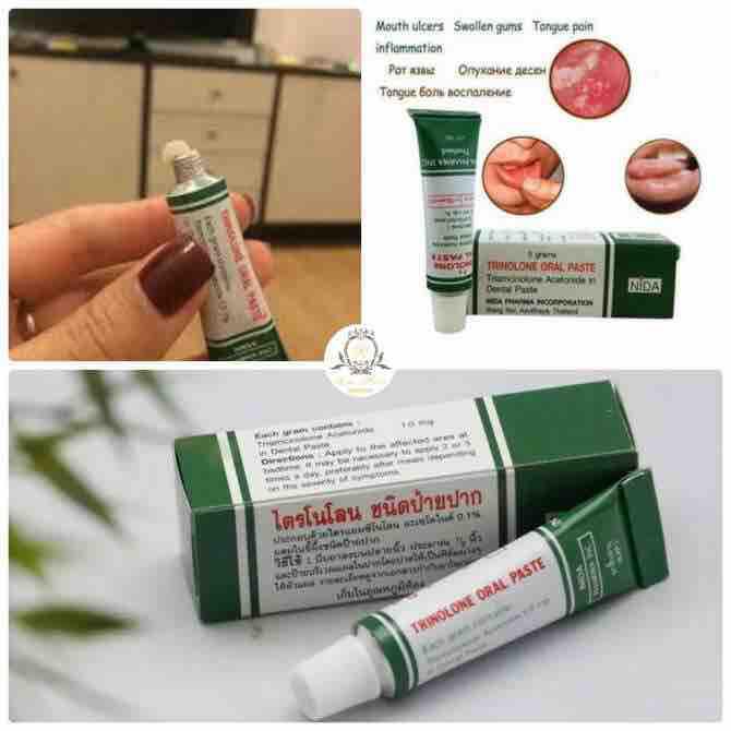 Kem trị nhiệt miệng Thái lan