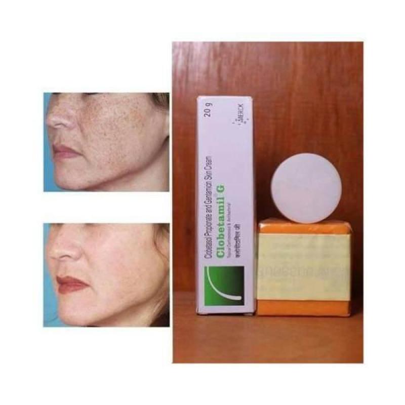 Bộ 3 món Trị Nám Tàn Nhang Clobetamil G Thái Lan, tặng thêm 2 gói dưỡng trắng da Garnier