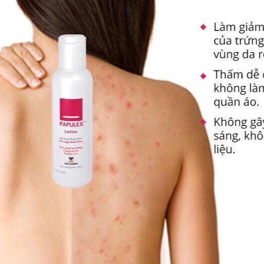 Papulex lotion 125ml