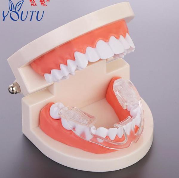 DỤNG CỤ CHO NGƯỜI NGHIẾN RĂNG chăm sóc răng miệng, bảo vệ răng, kỹ thuật của Nhật (Loại bỏ tật nghiến răng khi ngủ )