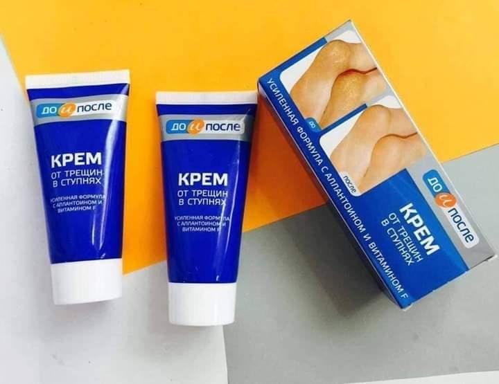KEM TRỊ NỨT GÓT CHÂN NGA