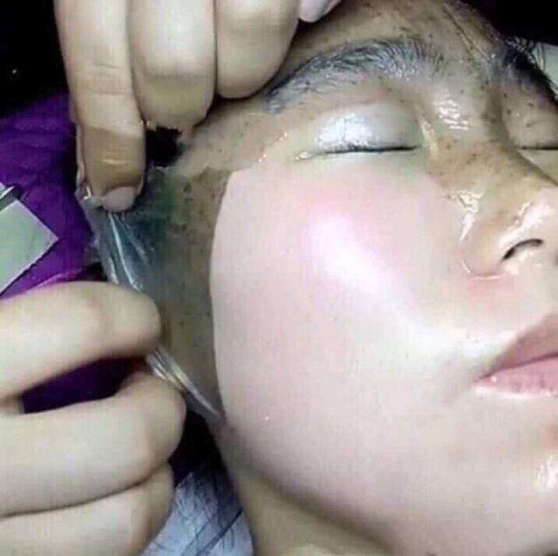 Mặt nạ tẩy da chết GoGo