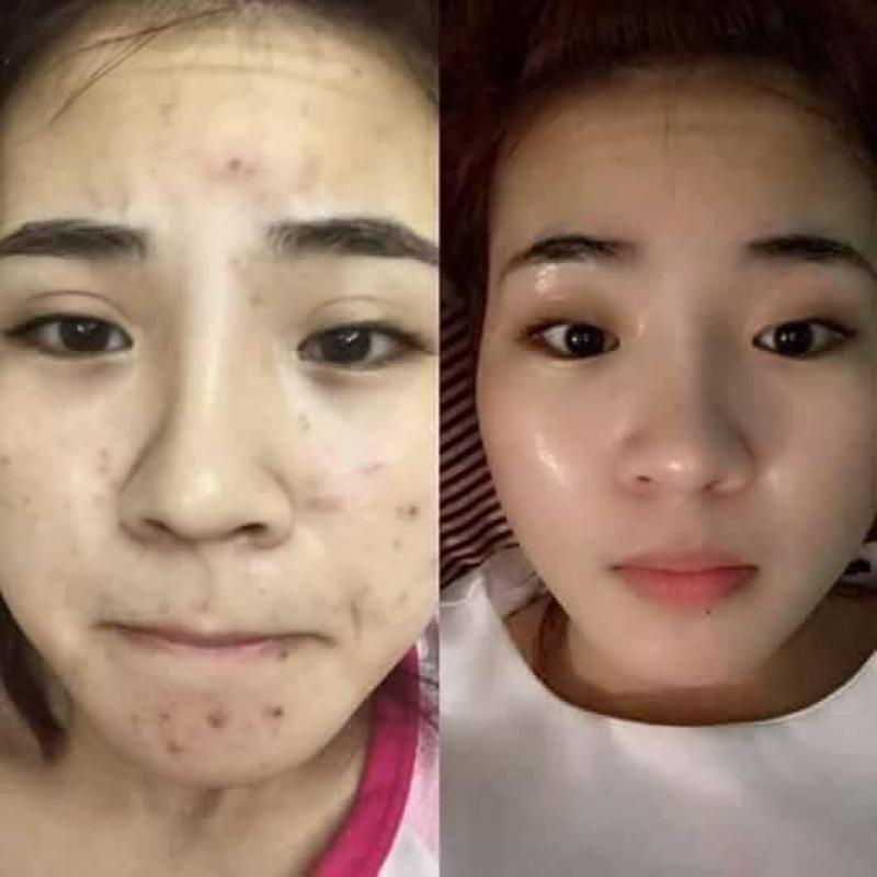 Mỡ trĂn N’store bán chạy