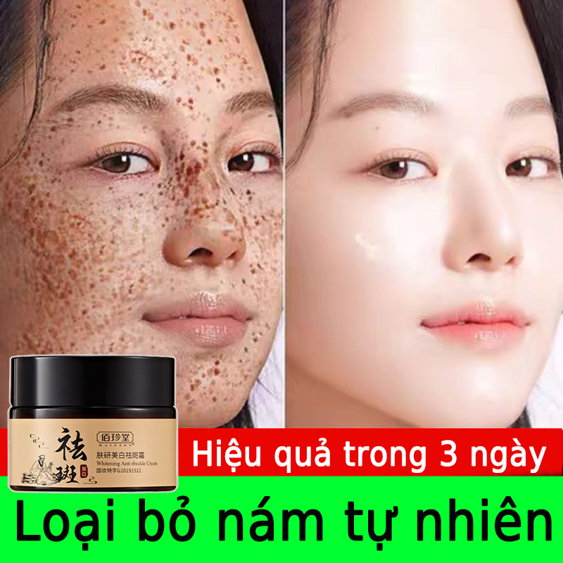 Kem xóa tàn nhang Kem dưỡng da mờ nám,làm trắng da 30g mờ nám tàn nhang mờ thâm mụn trắng da Toàn thân có sẵn-CHỐNG lÃO HÓA