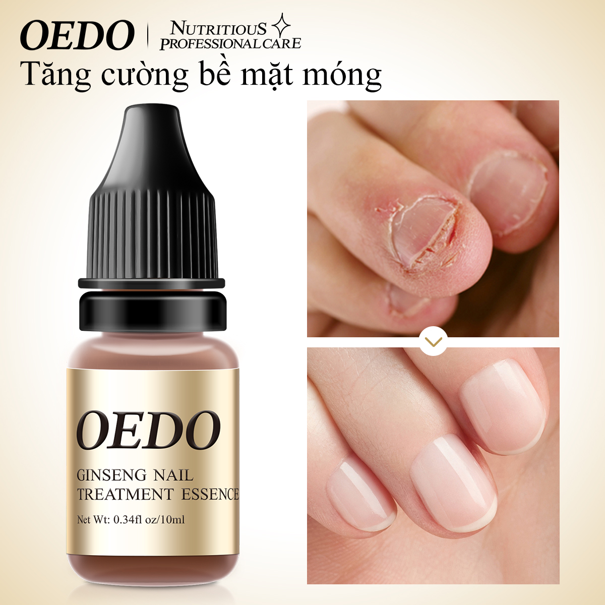 OEDO Trị nấm móng tinh dầu dưỡng móng hư tổn chiết xuất thảo dược giảm nấm móng tay chân kháng khuẩn,serum đánh bay nấm móng, hư khoé, bọng móng, thuốc trị nấm móng