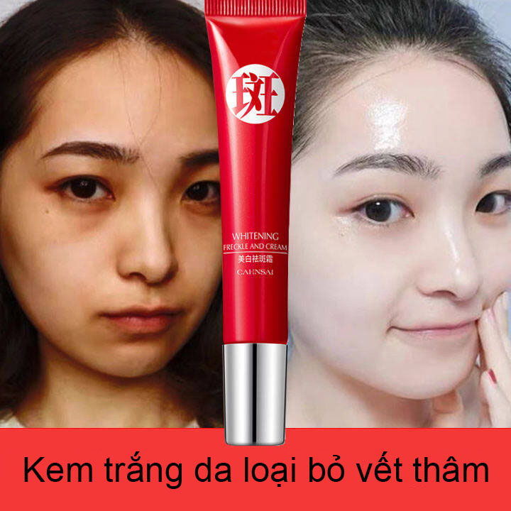 (Loại bỏ tàn nhang trong 7 ngày) Kem làm trắng và loại bỏ nám tàn nhang hiệu quả, loại bỏ các hắc tốt melanin và chăm sóc da trắng sáng tự nhiên Kem chăm sóc da mặt 20g