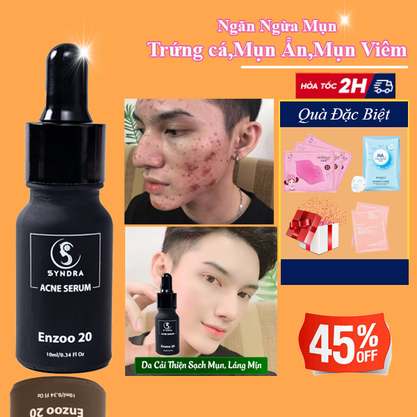 Serum mụn trứng cá ,enzzo20 giảm mụn ẩn dưỡng da ngừa thâm giúp da mịn màng trắng sáng hiệu quả sau 7 ngày