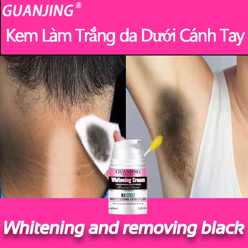 Kem trị thâm nách vùng bikini kem trị thâm nách nữ chân body chân đầu gối vùng kín làm trắng da và sáng da phụ nữ và nam giớitrị thâm nách