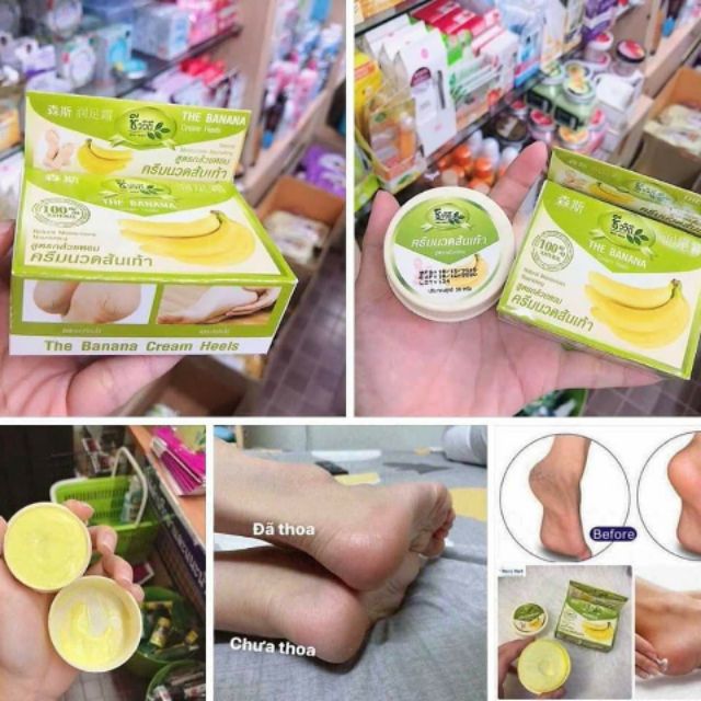 Kem chuối xoa nứt gót chân Thái Lan