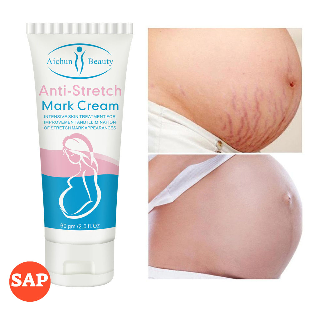 Kem làm mờ rạn da kem tái tạo da hiệu quả cho bà bầu Anti-stretch Marks Cream - mờ sẹo giảm thâm giảm nhăn do tăng cân hoặc mang bầu