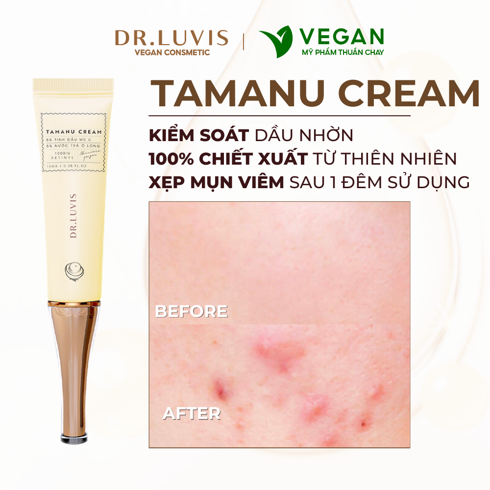 Kem mụn Mù U - Tamanu Cream Dr.Luvis loại bỏ thâm, giảm mụn, mờ sẹo