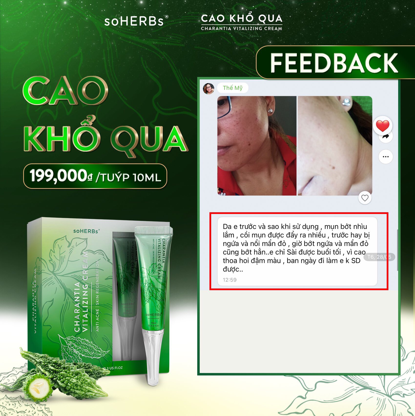 Cao khổ qua soherbs dành cho da mụn trắng da 10ml
