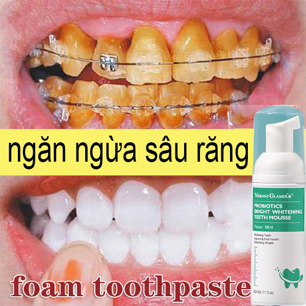 Kem đánh răng làm trắng răng 60ml Mousse làm trắng răng Nước súc miệng làm trắng răng chuyên nghiệp Làm trắng răng nhanh chóng Làm sạch răng loại bỏ mảng bám răng