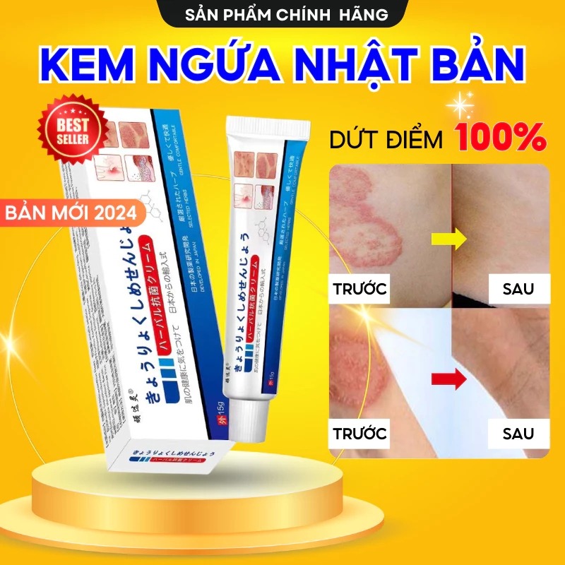 Kem Bôi Ngứa Da Nhật Bản 15g – Giảm Ngứa Nhanh, Khô Da, Nứt Nẻ, Mẩn Đỏ, Không Nhờn