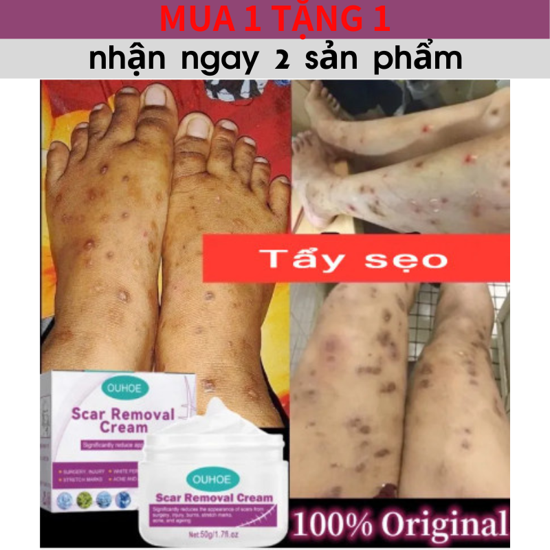  Kem trị sẹo Vết sẹo hỗ trợ trị sẹo mờ thâm rạn da Giảm Mụn bỏng phẫu thuật scar esthetique thuốc điều Trị 