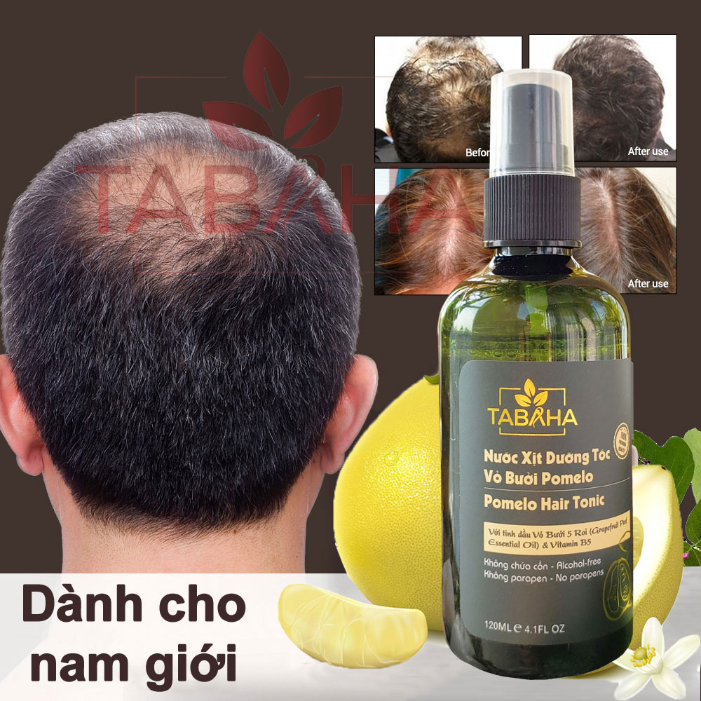[HCM]{Ngăn Hói Tóc Nam Giới} Xịt mọc tóc nhanh tinh dầu bưởi tabaha 120ml dành cho nam bị rụng tóc nhiều