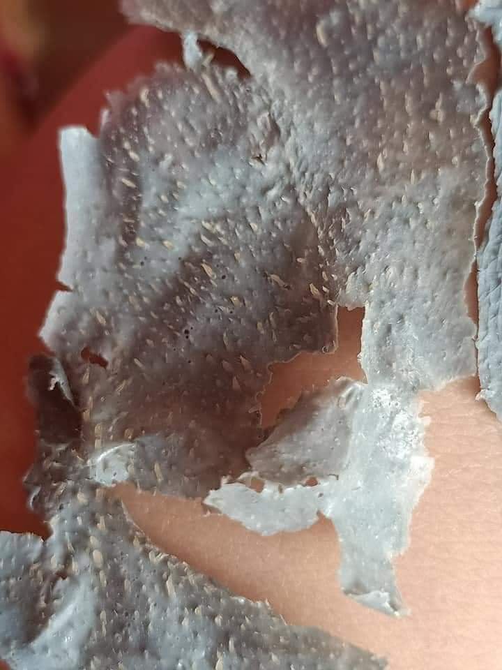 Gel Lột Mụn Dr.ACNE cty HAI AU VIET