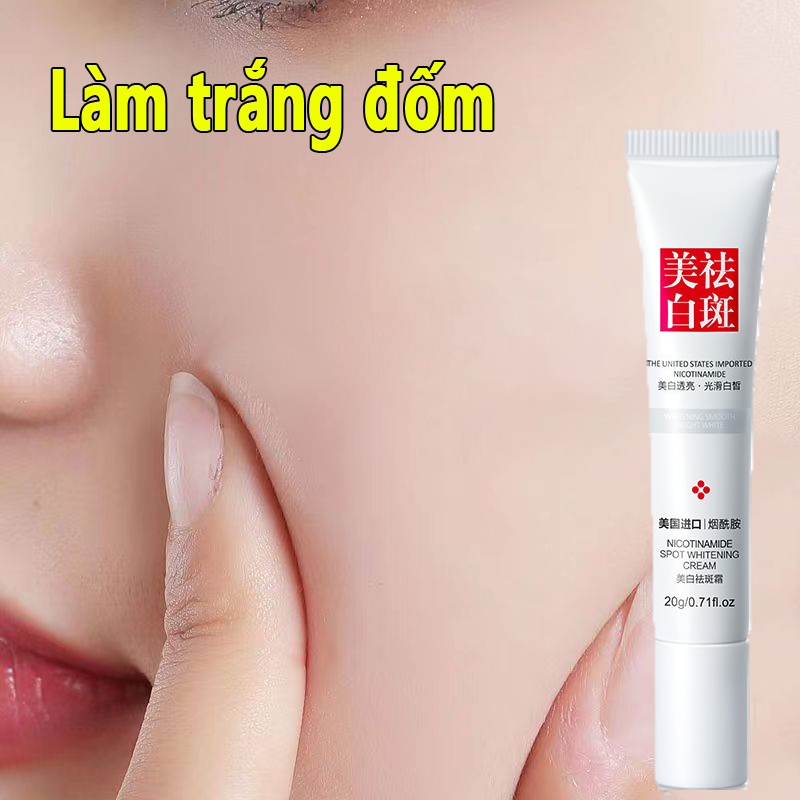 Kem Dưỡng Trắng Da Nám Tàn Nhang Giúp Làn Da Khỏe Mạnh kem nám tàn nhang 40g
