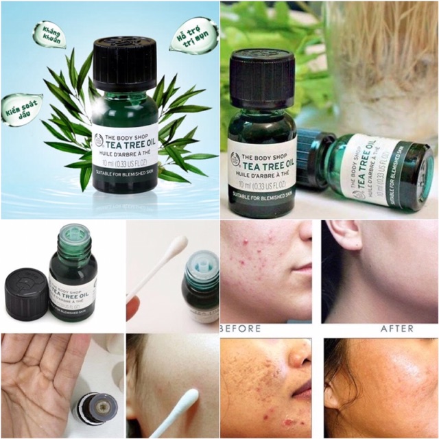 ♻️Tinh dầu tràm trà trị mụn The Body Shop Tea Tree Oil