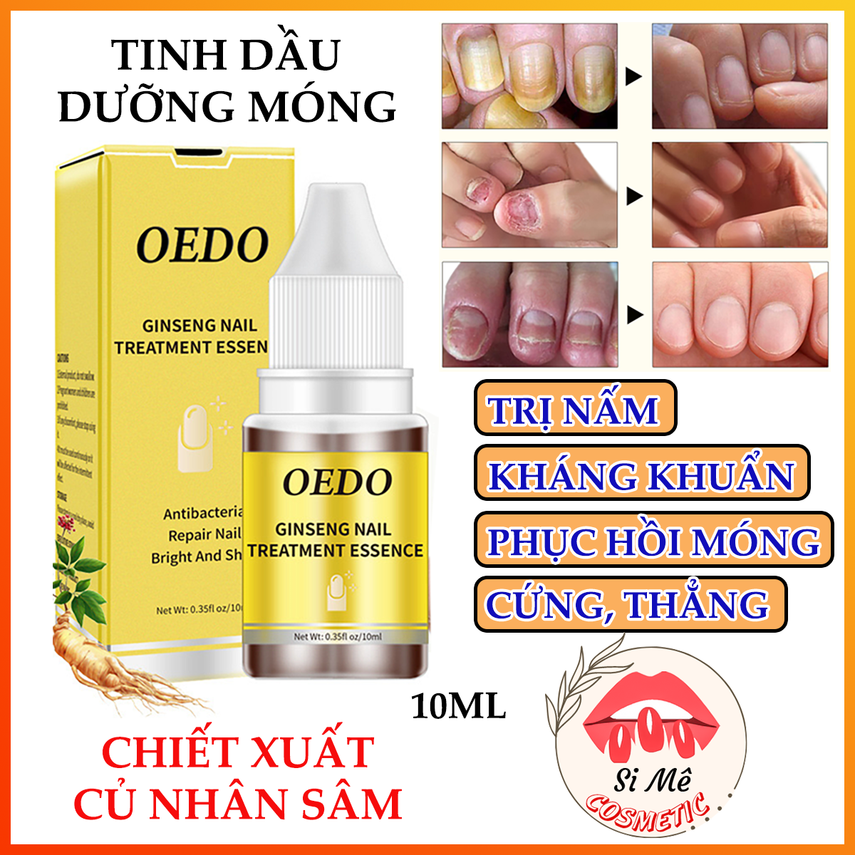 Tinh dầu dưỡng móng tay móng chân oedo chiết xuất thảo dược chai 10ml – loại bỏ nấm phục hồi móng hư tổn cho móng chắc khỏe