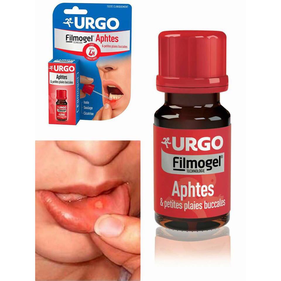 Gel loét miệng nhiệt miệng Urgo Mouth Ulcer hiệu quả trong lúc ăn