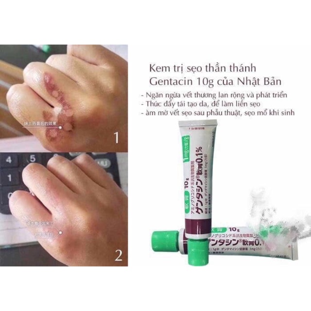 Kem liền sẹo Gentacin Nhật Bản 10g