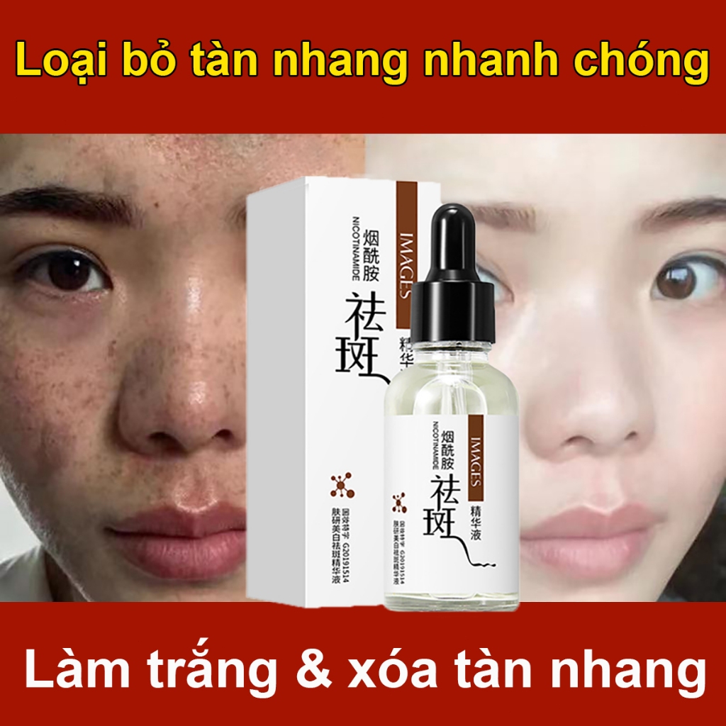 Serum làm trắng da chống tàn nhang hiệu quả niacinamide tẩy tàn nhang serum làm trắng vết thâm Loại bỏ đồi mồi nám hỗn hợp thâm mụn hắc tố