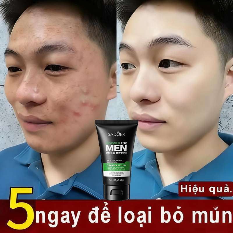 Sữa rửa mặt ngừa mụn nam sạch dầu nhờn, ngăn ngừa mụn ẩn, chăm sóc da Nhờn Làm Sạch Sâu, Dưỡng Ẩm Làm Trắng Da 100g