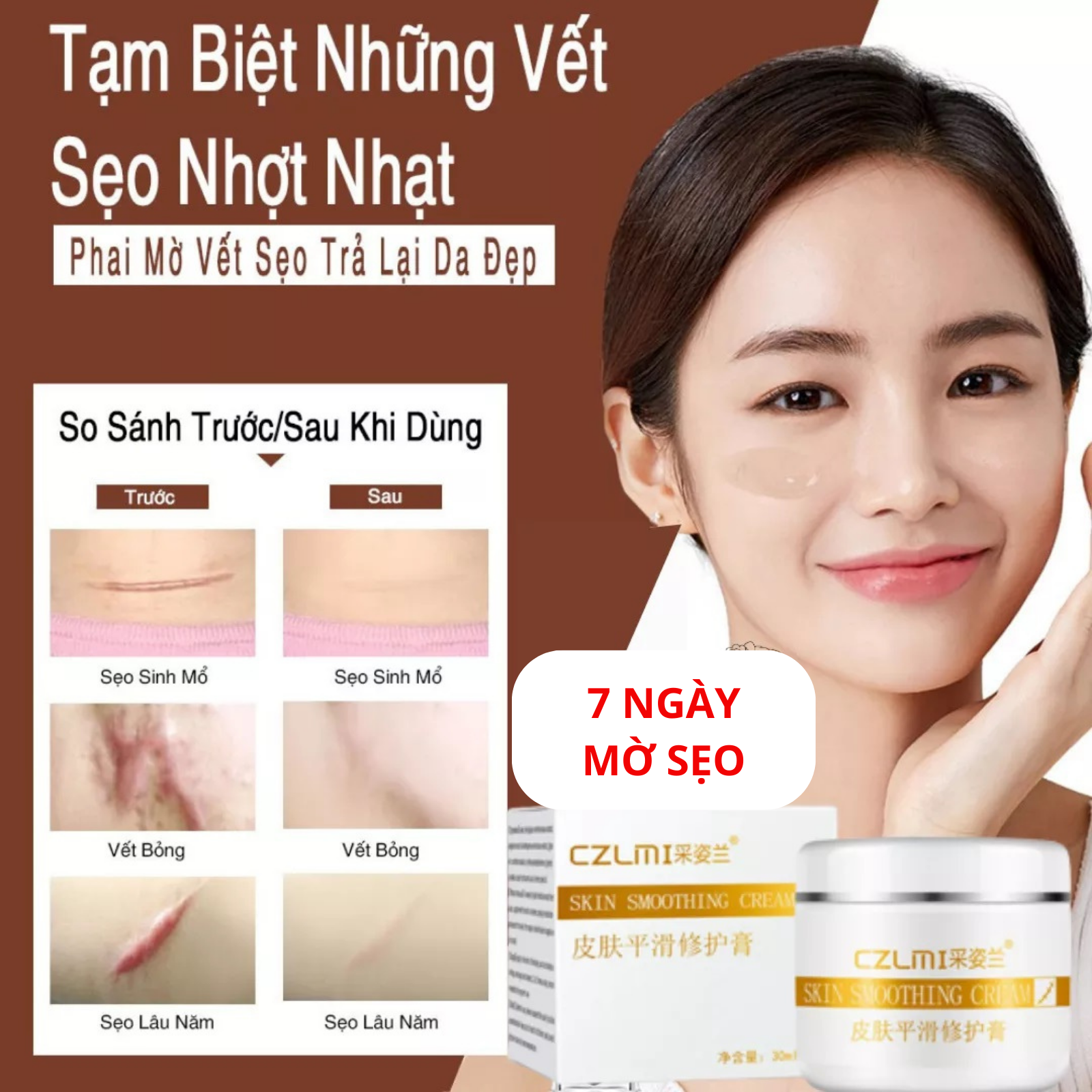Kem mờ sạch các loại sẹo loại bỏ 100% sẹo làm hết rạn da sáng da dánh bay mọi vết thâm sẹo thâm bỏng thâm mụn caizila 30g
