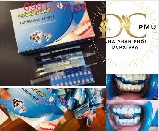 Thuốc tẩy trắng răng pha sẵn