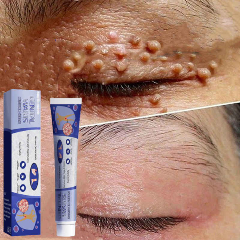 Kem điều trị xương khớp kem collagen khớp giảm đau khớp tự nhiên kem điều trị xương khớp 30g