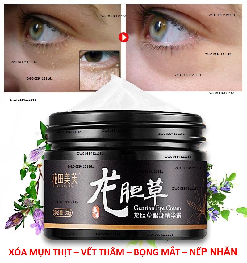 11HỘP XÓA MỤN THỊT - BỌNG MẮT - ĐÁNH BAY QUẦNG THÂM QUANH MẮT - SÁT MẮT - LÀM MỜ VẾT NHĂN - MỊN DA - 1A12 OK [ NHIỀU LƯỢT TRUY CẬP ]