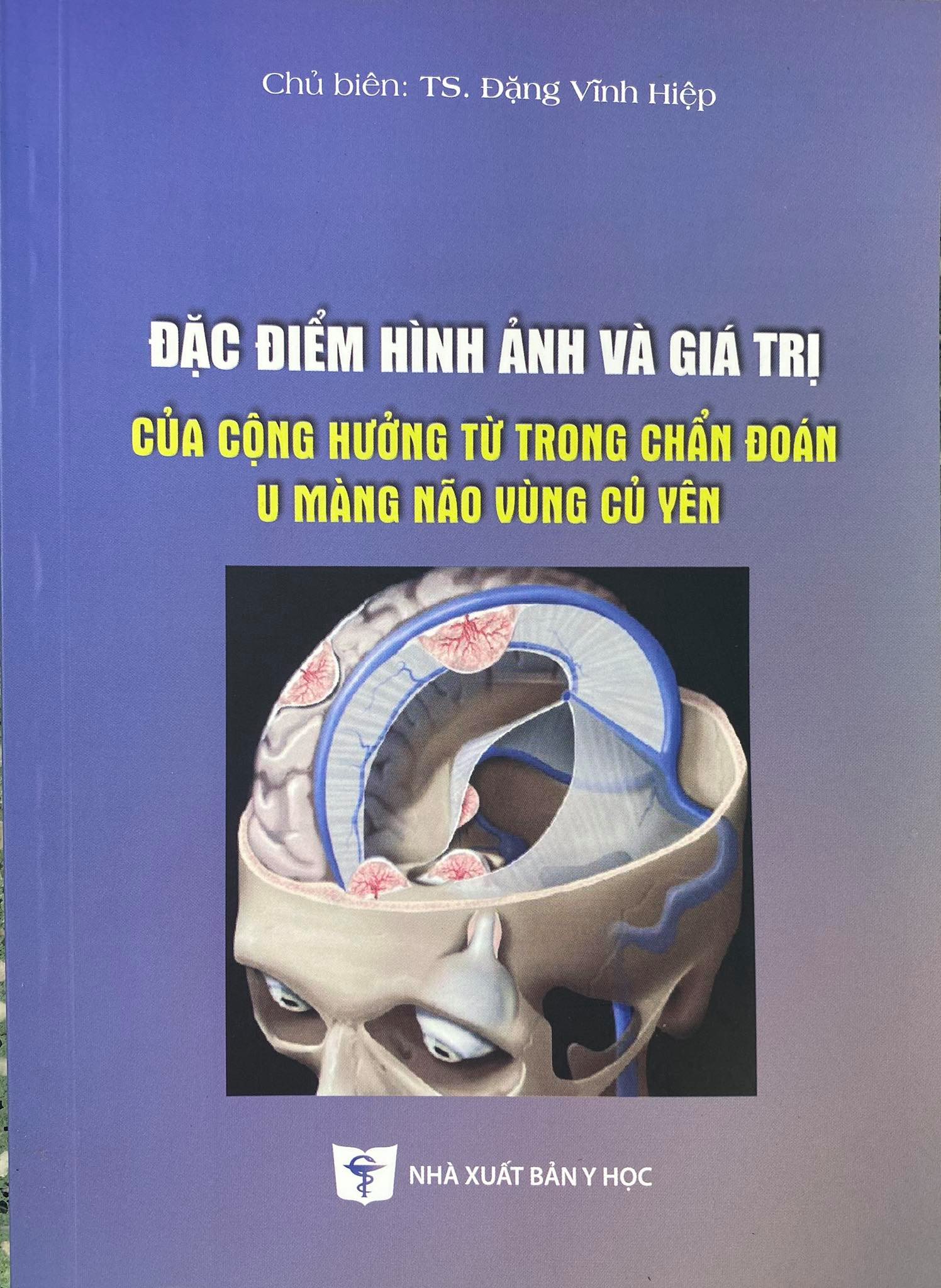Đặc điểm hình ảnh và giá trị của cộng hưởng từ trong chẩn đoán u màng não vùng củ yên (TS.Đặng Vĩnh Hiệp))