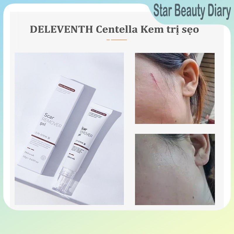 Deleventh centella kem làm mờ sẹo giảm sẹo và vết rạn da làm sáng màu da 18g