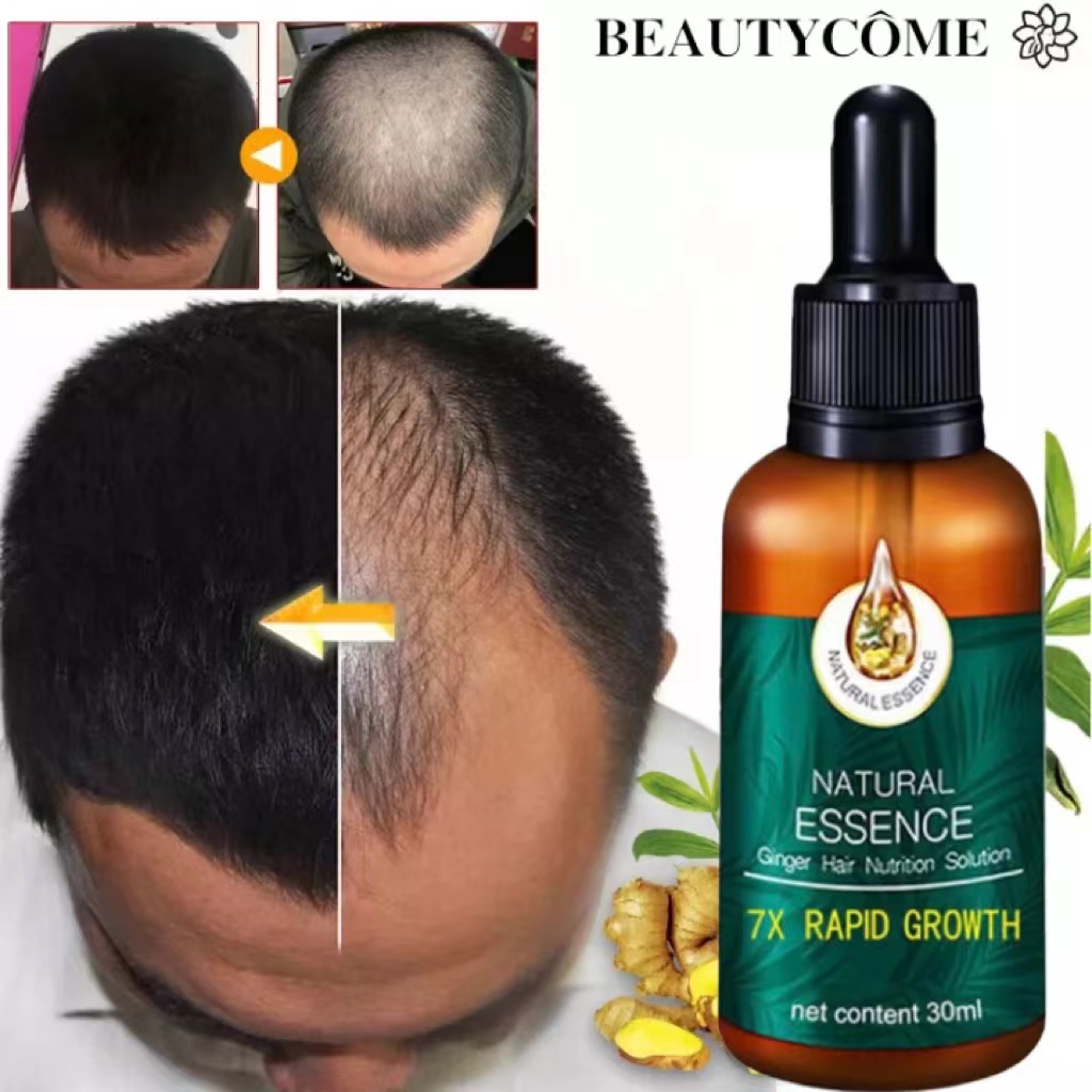 Tinh dầu kích mọc tóc nhanh ngăn ngừa rụng tóc chai tinh dầutinh chất giúp tóc mọc nhanh chống rụng tóc Tinh chất tăng trưởng tóc nhanh Hair Grower Dầu xả tóc Tinh chất ngăn ngừa rụng tóc cho nam và nữ 30ML