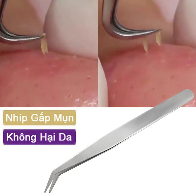 Combo 2 nhíp lấy mụn cong