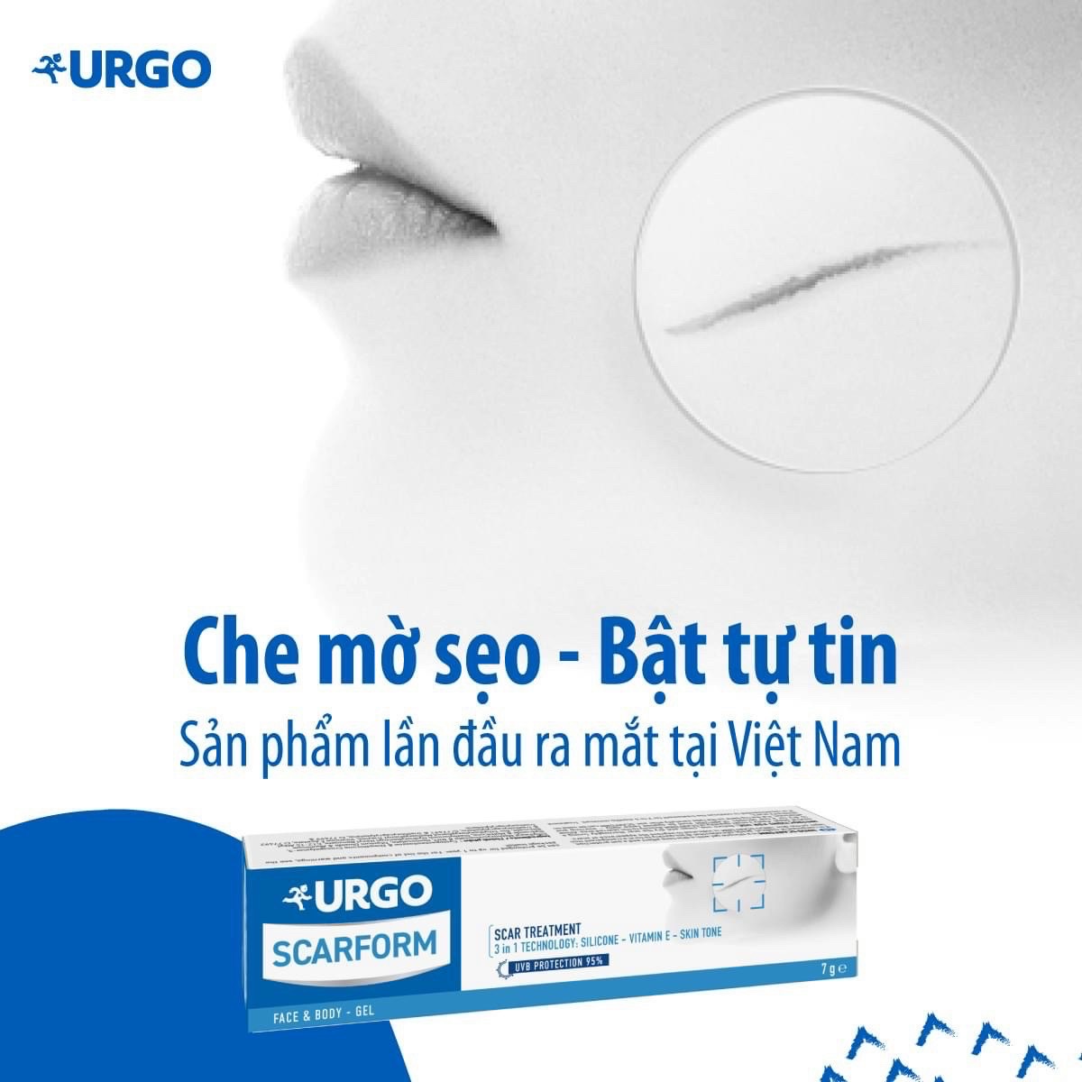 Gel xử lý sẹo - Urgo Scarform 7g