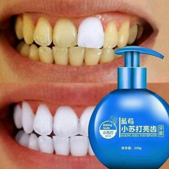 Kem tẩy trắng răng