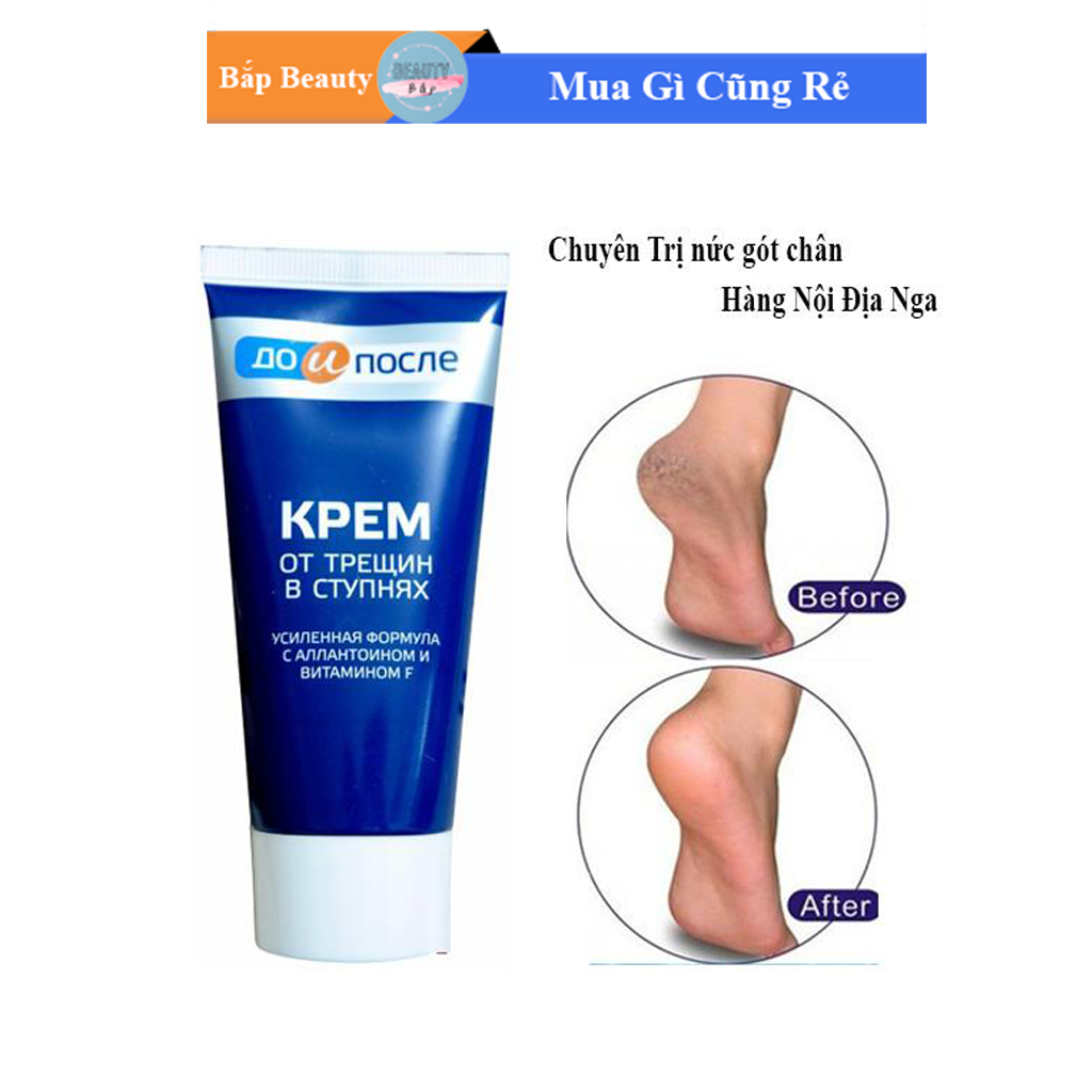Kem dưỡng gót chân Kpem Apteka của Nga 50ml