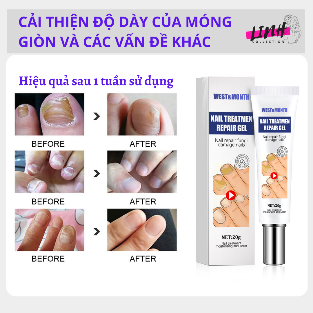 Gel Loại Bỏ Nấm Móng Tay Chân Tạo móng mới NAIL TREATMENT REPAIR GEL 20ml CHĂM SÓC DƯỠNG ẨM SÁNG BÓNG MÓNG
