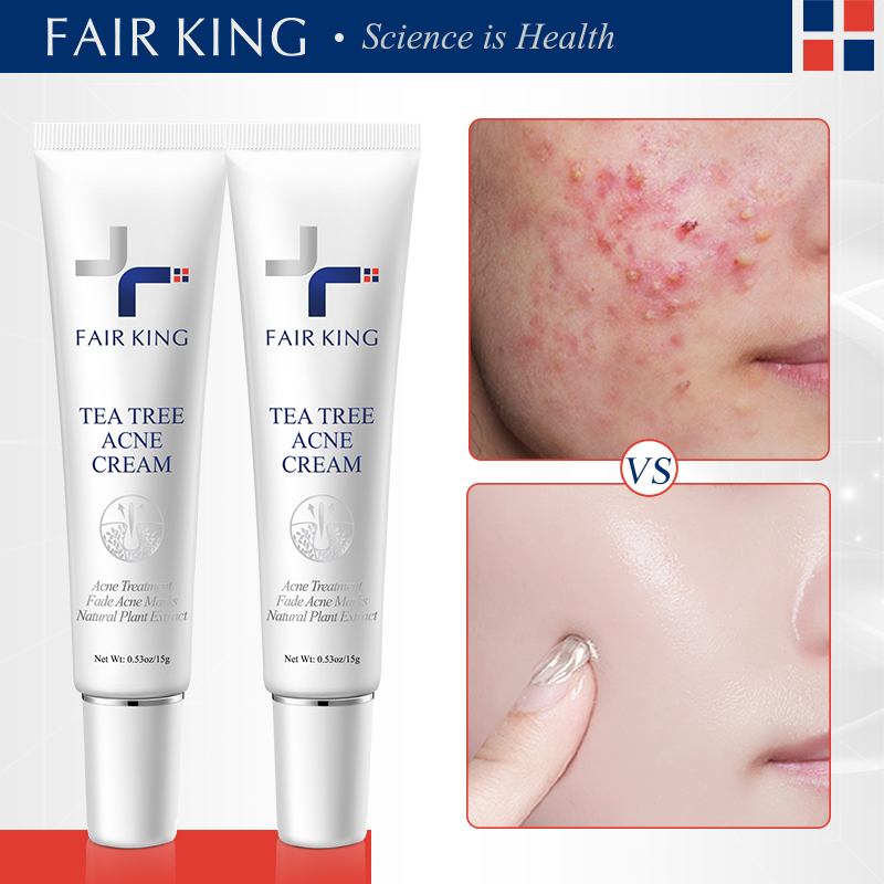 FAIR KING 2 gói Xóa Kem Chống Mụn Làm Trắng Da Mặt Làm Sạch Sâu Vết Sẹo Mụn Thu Nhỏ Lỗ Chân Lông Kem Sửa Mụn Đầu Đen-Quốc Tế