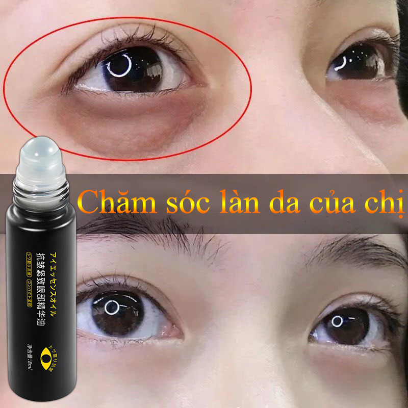 Kem dưỡng mắt Thanh Lăn Massage Tinh chất dưỡng mắt, Thanh lăn tan bọng mắt, Giảm nếp nhăn quanh mắt, Giảm thâm quầng mắt, đánh tan bọng mắt, dưỡng da vùng mắt, giảm nếp nhăn, chân chim Eye Beauty Massage