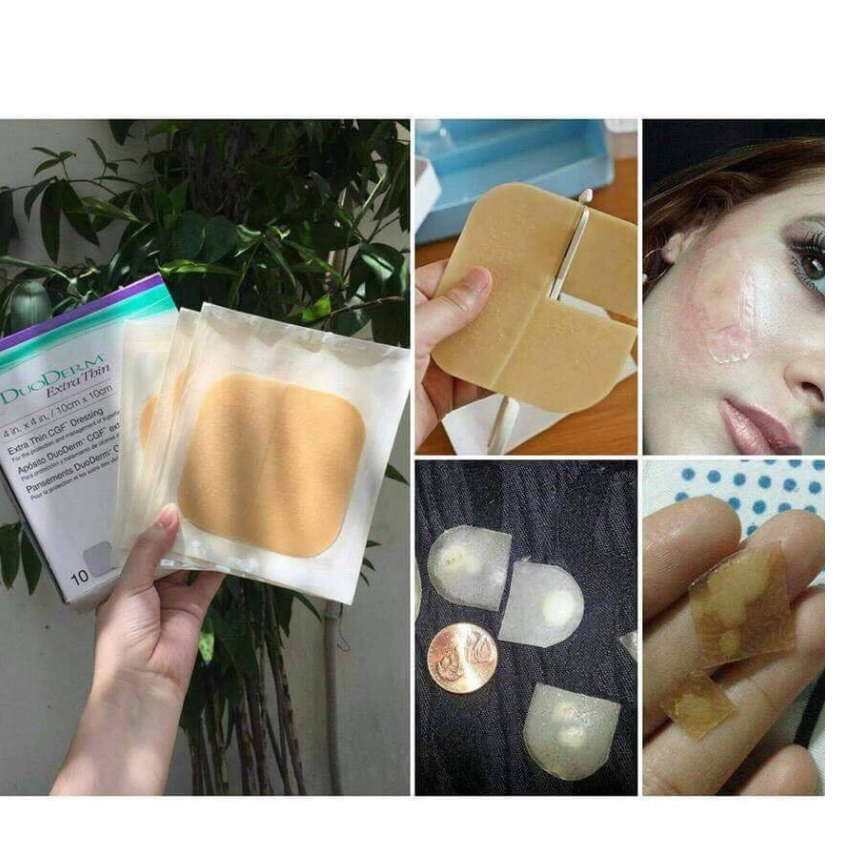 Các loại Miếng dán mụn Duoderm Extra Thin (khỏi lo mụn mủ) các loại