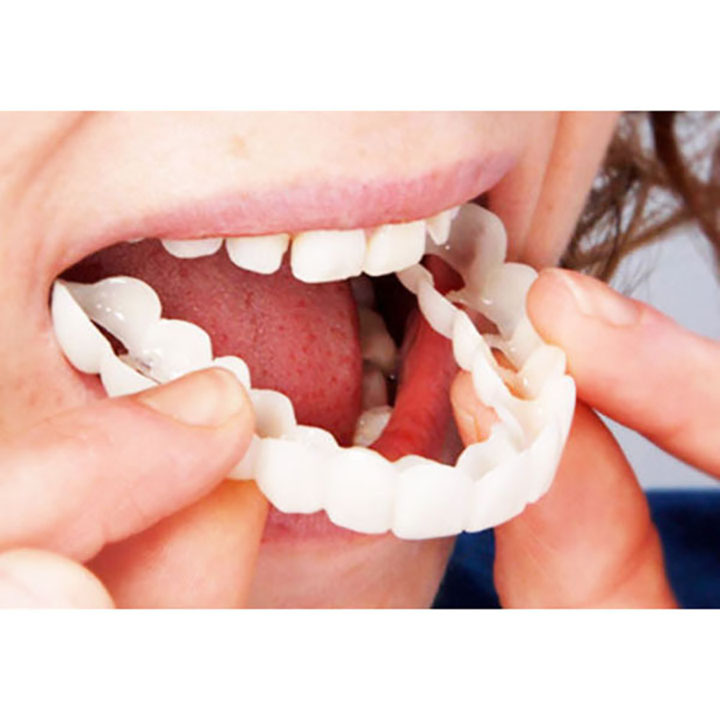 Răng giả snap on smile cải thiện đem lại nụ cười tự tin rạng ngời - KD0117