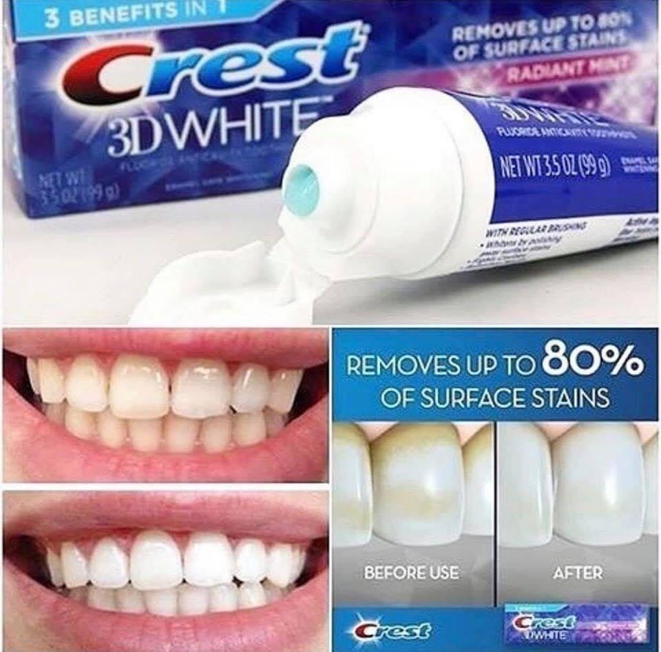 Kem đánh trắng răng siêu thích crest 3d white 158gr của mỹ