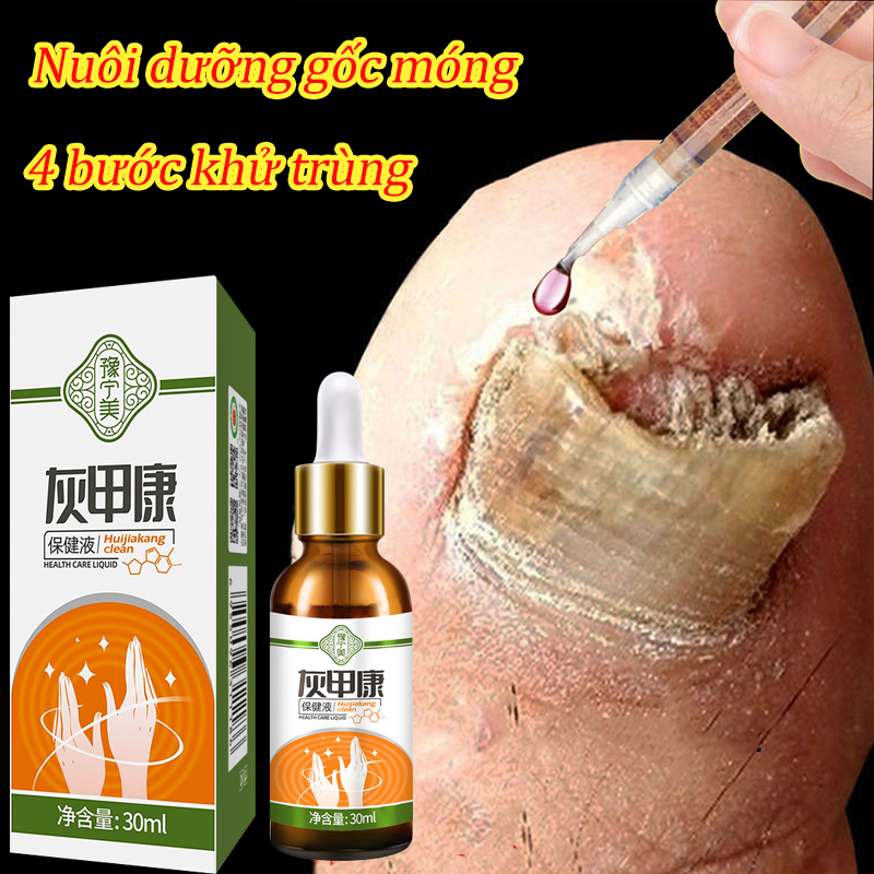 Serum phục hồi nấm móng chân loại bỏ nấm móng gãy móng chống các bệnh nấm móng kháng khuẩn 30g dùng cho móng chân tay hiệu quả nhanh dùng cho nam và nữ