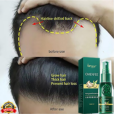 Tinh dầu mọc tóc xịt tinh dầu chống rụng tóc mọc tóc nhanh ngăn ngừa rụng tóc kích thích mọc tóc dầu dưỡng tóc Hair Growth Essence hair
