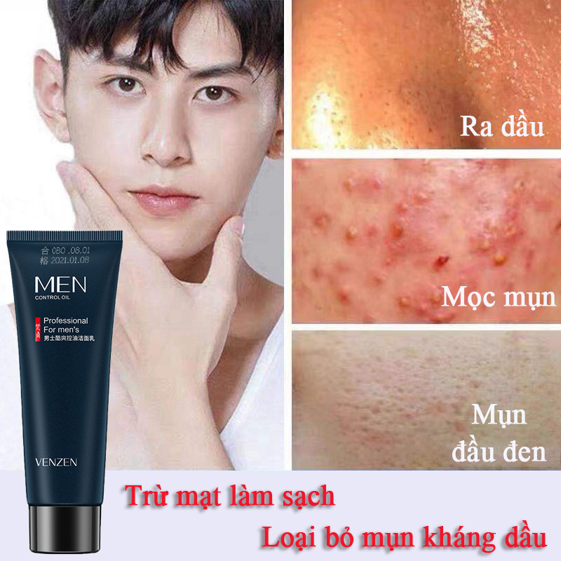 Sữa rửa mặt cho nam sữa rửa mặt trắng da lành mụn loại bỏ mụn đầu đen mụn cám ở nam giới dưỡng da trắng sáng mịn màng thu nhỏ lỗ chân lông 80g