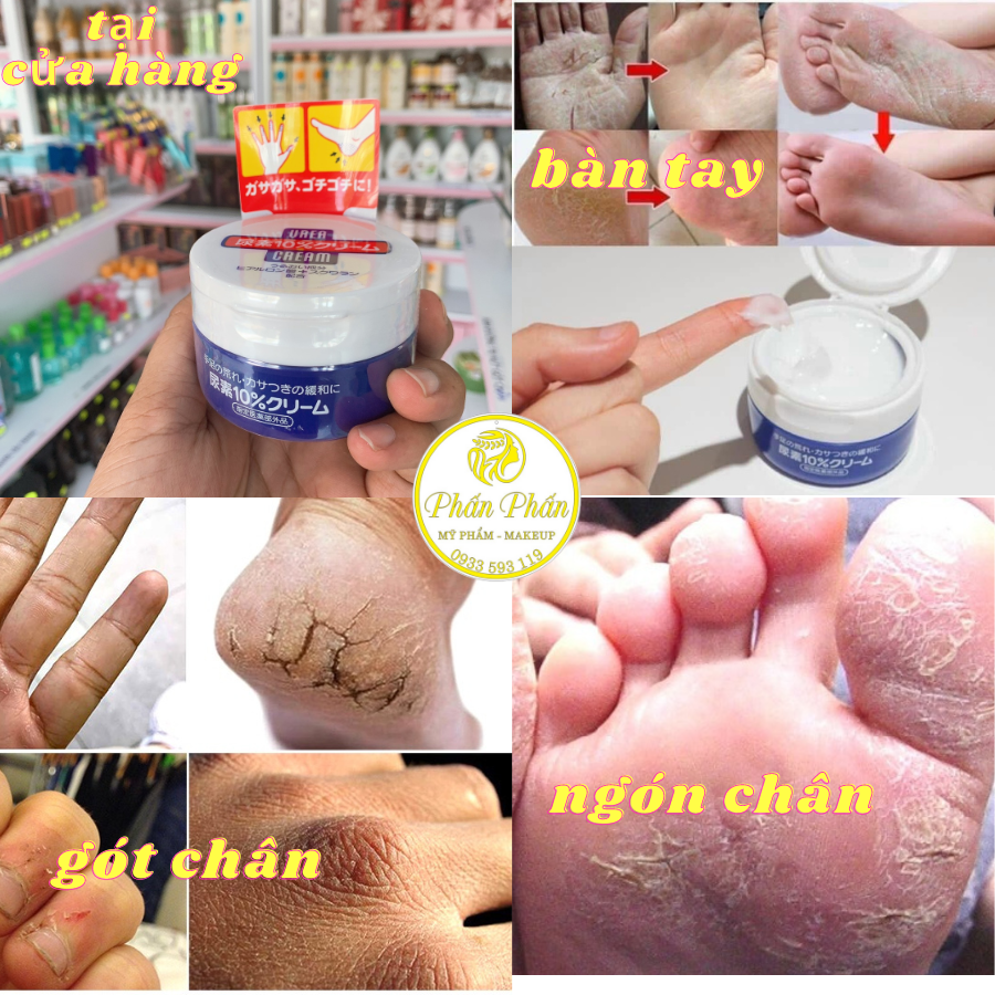 Kem dưỡng trị nứt tay, gót chân Shisedo Nhật Bản 100g